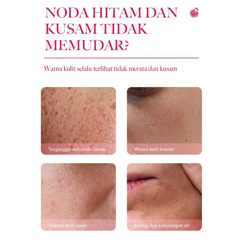 kormesic pomegranate niacinamide 3% moisturizer cream 50g/cream wajah kormesic pomegranate niacinamide 3% moisturizer cream 50g/cream wajah