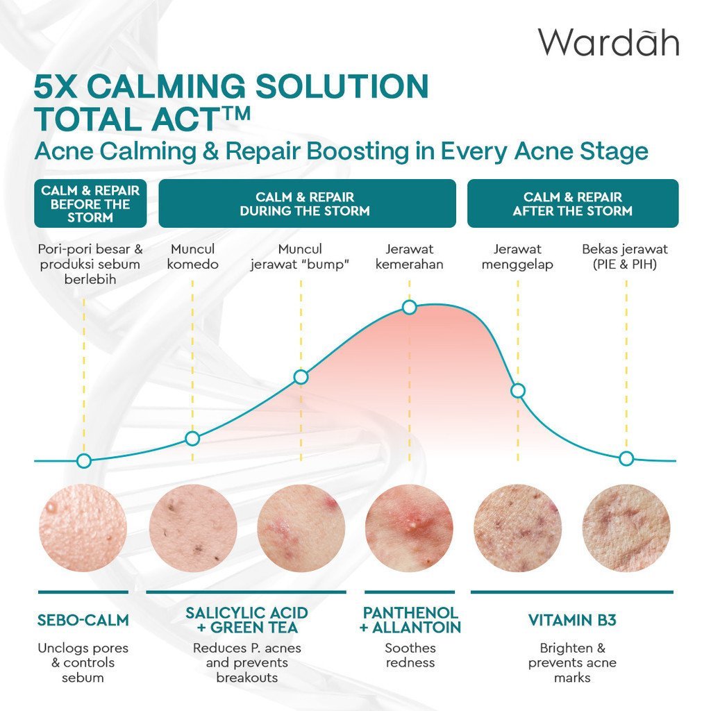 wardah uv shield acne calming sunscreen serum spf 50 pa++++ 40ml wardah uv shield acne calming sunscreen serum spf 50 pa++++ 40ml