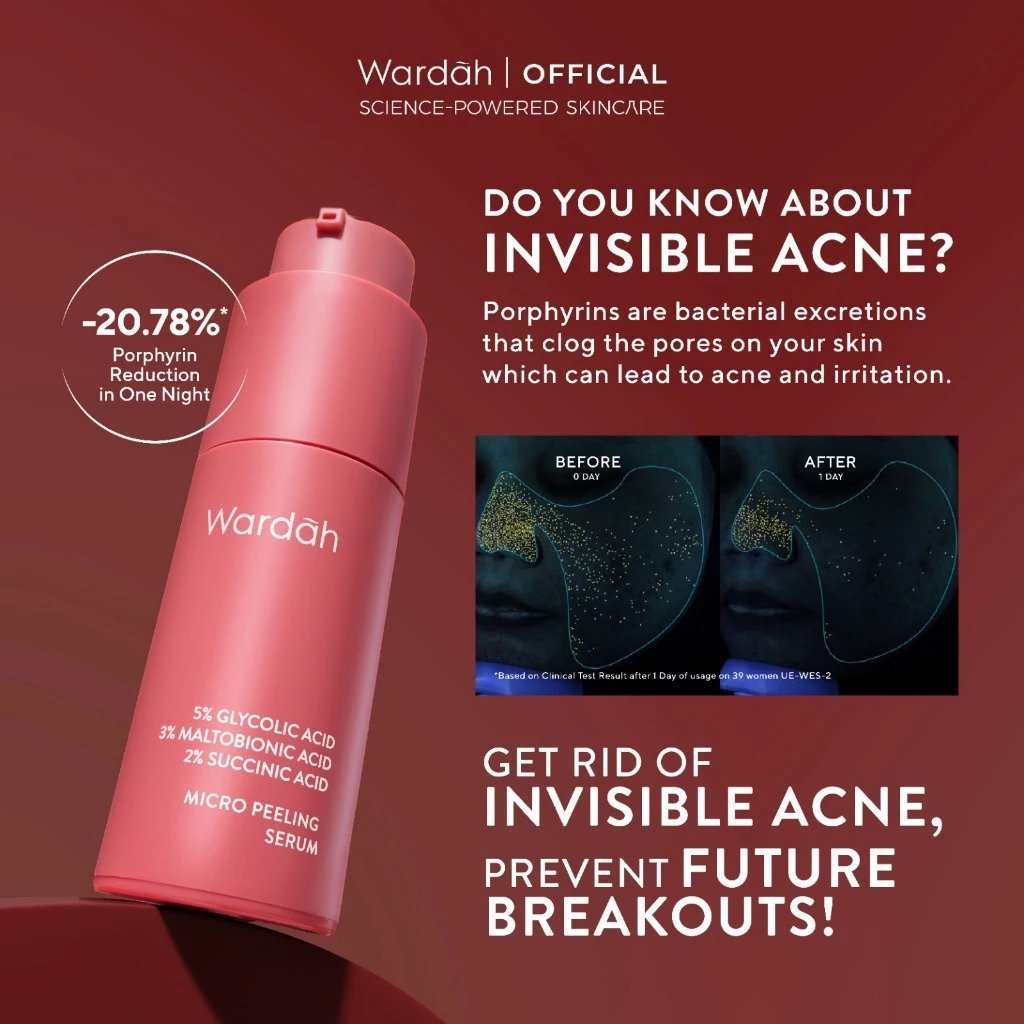 wardah 5% glycolic acid micro peeling serum 20ml / serum wajah wardah 5% glycolic acid micro peeling serum 20ml / serum wajah
