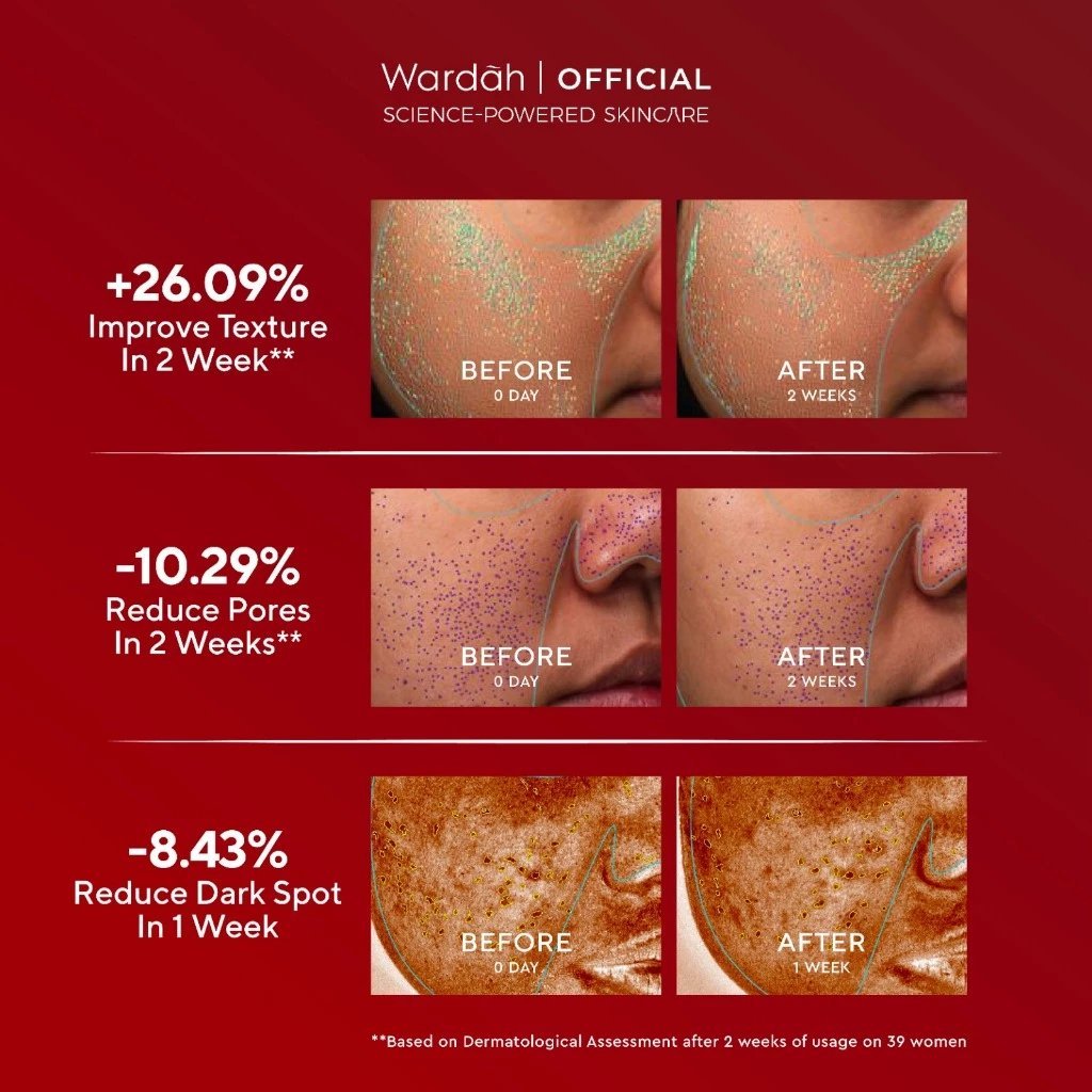 wardah 5% glycolic acid micro peeling serum 20ml / serum wajah wardah 5% glycolic acid micro peeling serum 20ml / serum wajah
