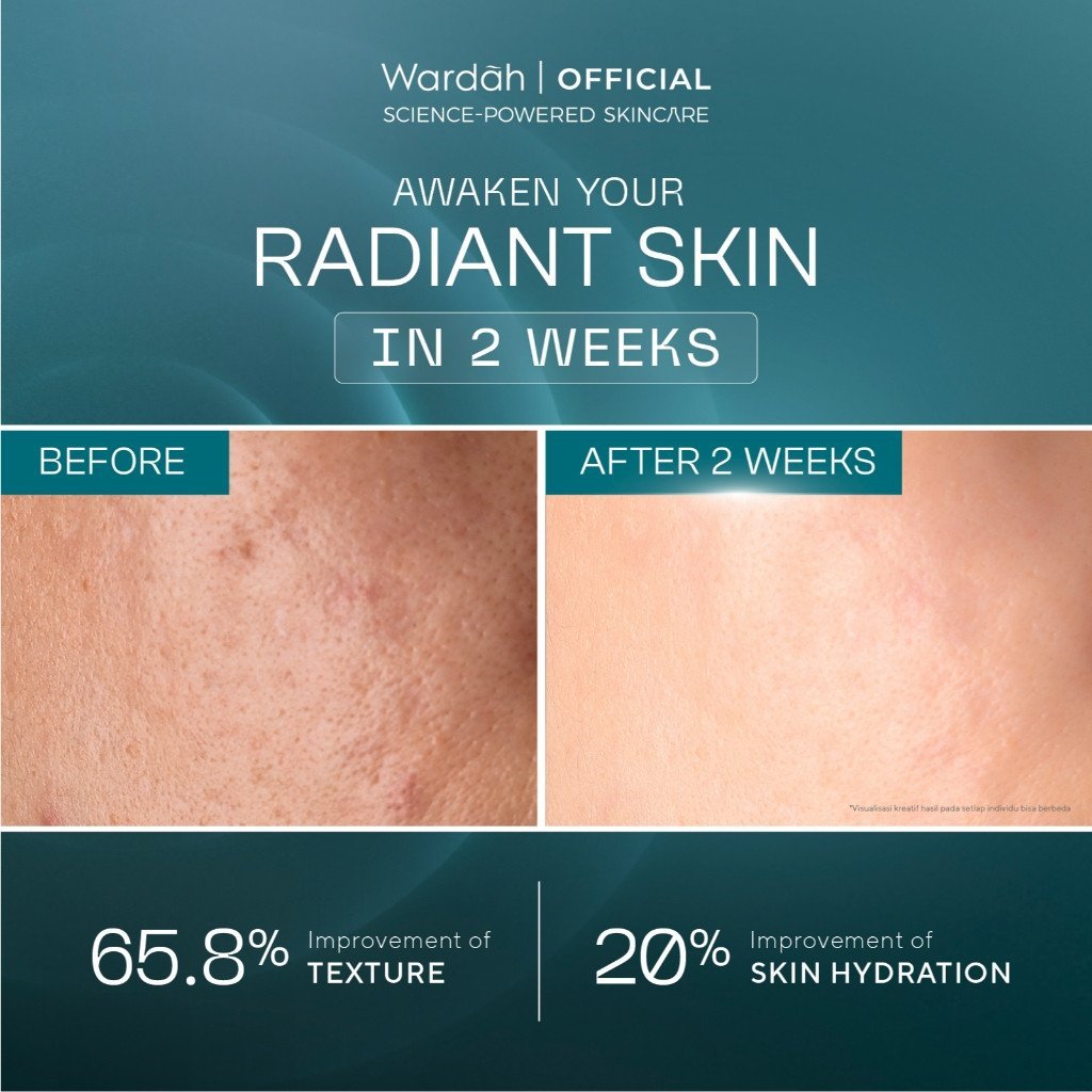 wardah retinal liposome cysteamine radiant resurfacing serum 30ml/serum wajah wardah retinal liposome cysteamine radiant resurfacing serum 30ml/serum wajah